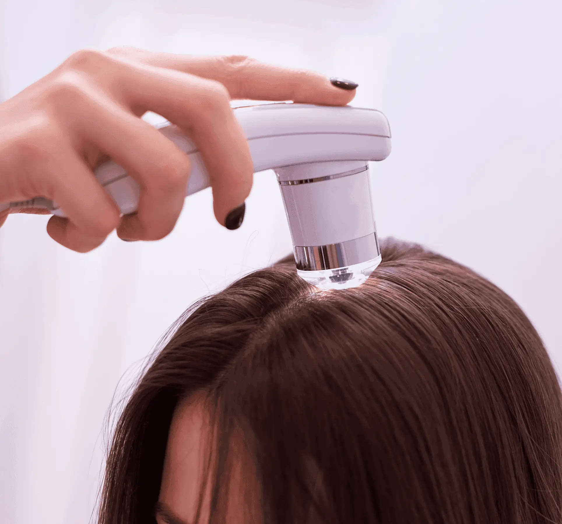 TRICOSCOPIA Tratamentos Capilares