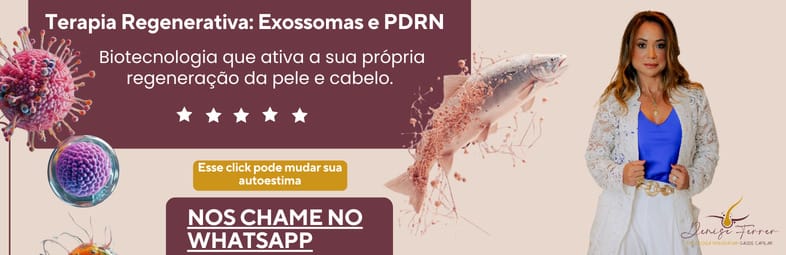 Banner de conversao Denise Ferrer