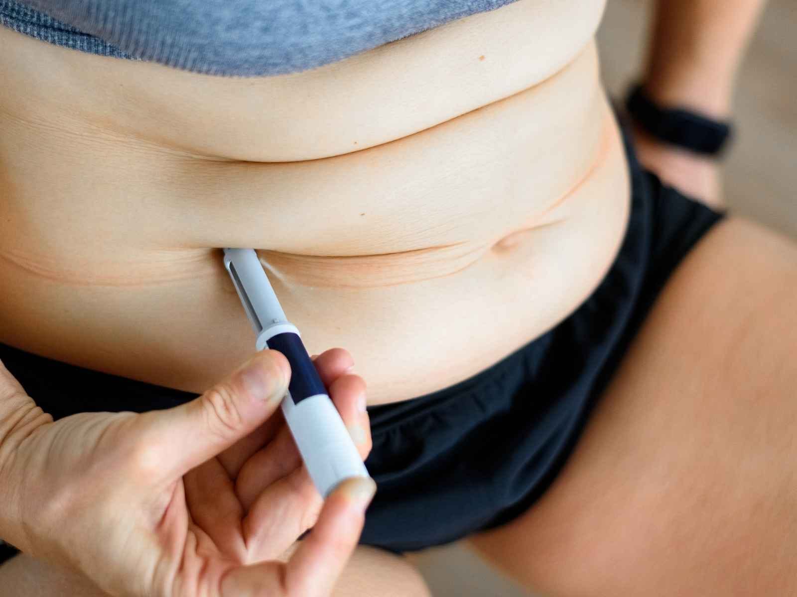 canetas emagrecedoras causam queda de cabelo