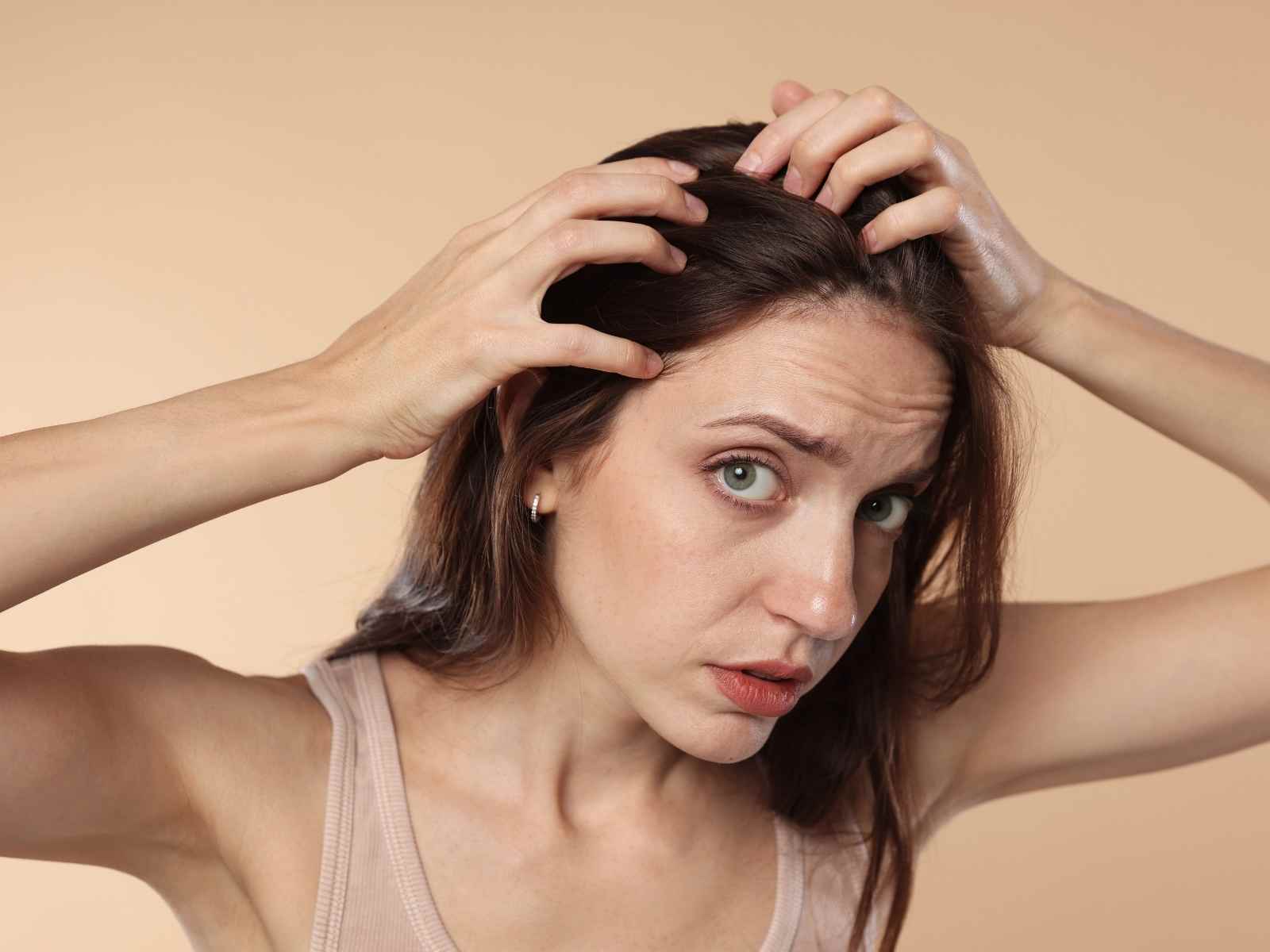 Como reverter a calvície feminina